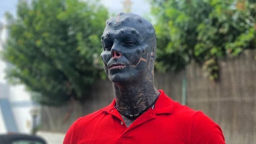 "Hombre alien" se amputará una pierna para completar su transformación; así luce actualmente