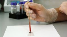 Oncoliq: conoce el test que puede detectar el cáncer con solo una muestra de sangre