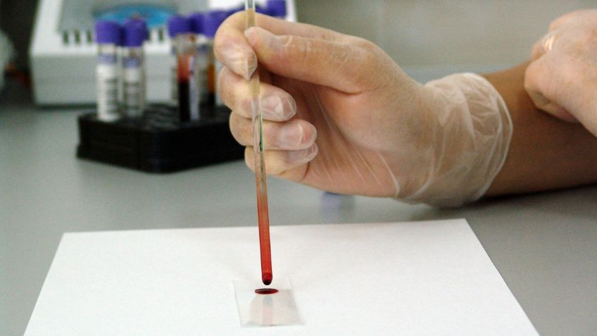 Oncoliq: conoce el test que puede detectar el cáncer con solo una muestra de sangre