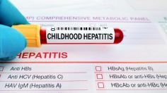 Hepatitis y cómo saber si tengo esta enfermedad