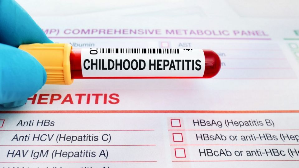 ¿Cómo prevenir enfermarse de hepatitis? 
FOTO: Freepick