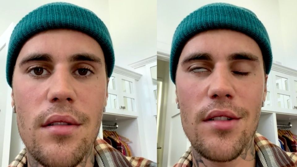 Justin Bieber acaba de anunciar que padece síndrome de Ramsay Hunt