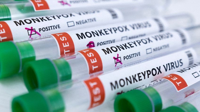 OMS evaluará la viruela del mono y su alcance de contagio a nivel mundial