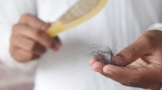 Alopecia: Ya hay tratamiento comprobado que combate la calvicie