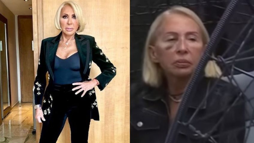 ¿Quién le pegó a Laura Bozzo en LCDLF2? La razón detrás de su ojo morado