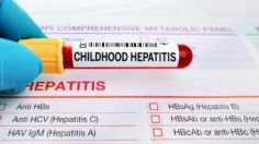 OMS: Se registran más de mil casos de hepatitis infantil aguda en el mundo; 22 de ellos fueron mortales