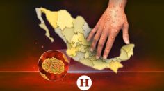 Viruela del mono en México: MAPA de los ESTADOS donde han aumentado los casos