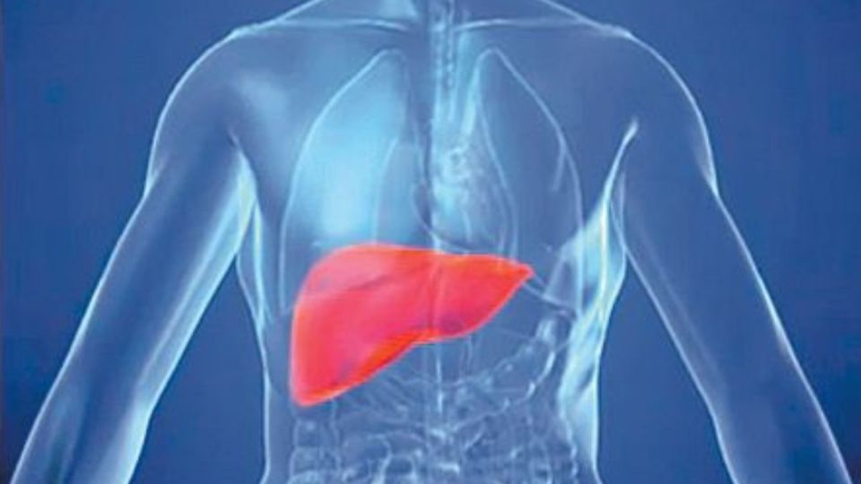 La Hepatitis es la inflamación del hígado