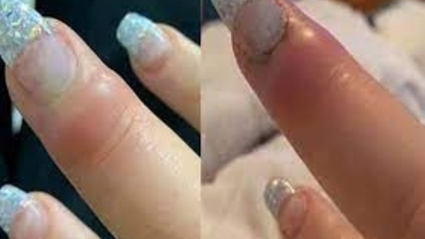 Los riesgos de las uñas acrílicas