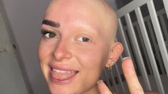 Alopecia en mujeres: Influencer revela su rutina de maquillaje para lucir cejas y pestañas naturales