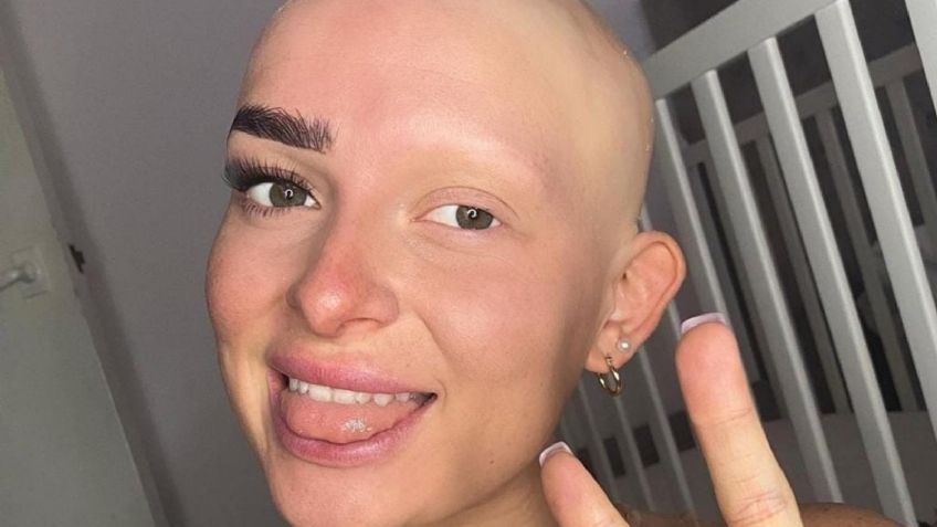 Alopecia en mujeres: Influencer revela su rutina de maquillaje para lucir cejas y pestañas naturales