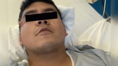 VIDEO | Un hombre creyó que tenía un grano en la cara, pero resultó ser un tumor