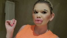 FOTOS | Andrea Ivanova, la joven bulgara que desea parecerse a Barbie y ha recibido más de 30 inyecciones tan sólo en los labios