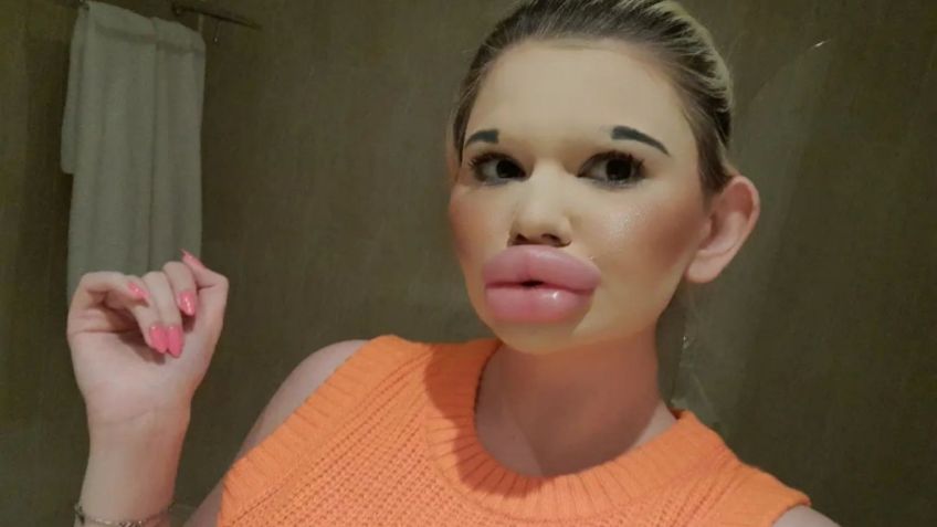 FOTOS | Andrea Ivanova, la joven bulgara que desea parecerse a Barbie y ha recibido más de 30 inyecciones tan sólo en los labios