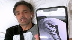 Eugenio Derbez revela fuertes detalles de su accidente: "Se me salió el hueso del hombro"