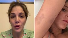 Natalia Alcocer revela VIDEOS de las brutales agresiones de su ex pareja: “Soy el anuncio de un feminicidio”