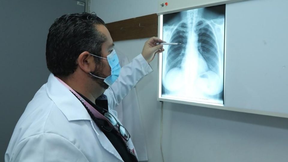 Enfermedad crónica y multisistémica que daña diferentes órganos, principalmente pulmones y sistema digestivo