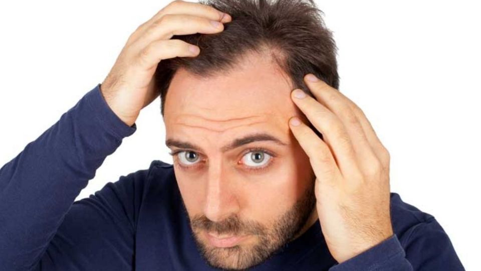 ¡Que el cabello deje de ser un problema! Con este remedio puede incentivar el crecimiento capilar