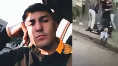 VIDEO: dan golpiza a un joven por defender a su amigo, ahora usará una prótesis en la cara