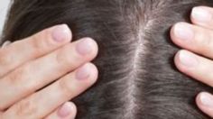 Conoce la edad en la que aparecen las primeras canas del cabello