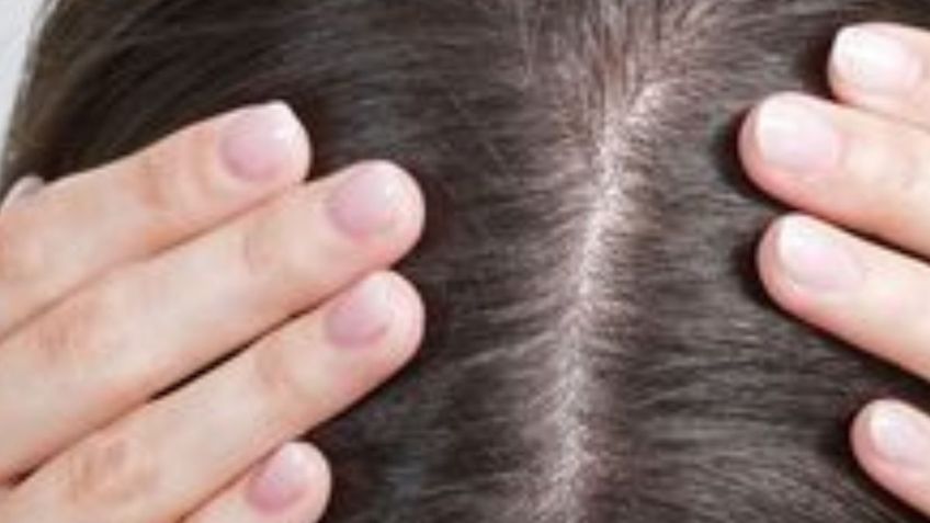 Conoce la edad en la que aparecen las primeras canas del cabello