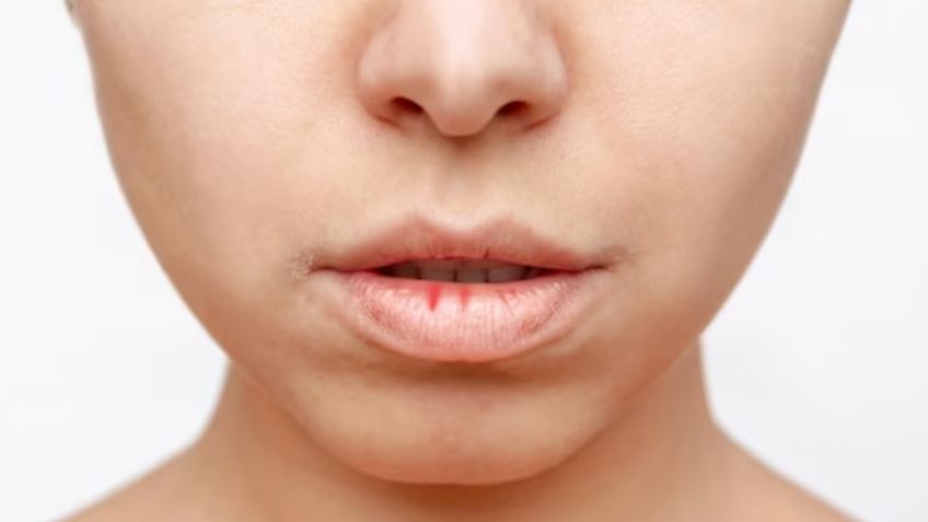 Labios partidos: así puedes crear un bálsamo casero súper efectivo contra el frío