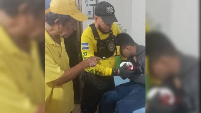 Joven termina con los dedos de la mano amputados por explotar pirotecnia en Navidad