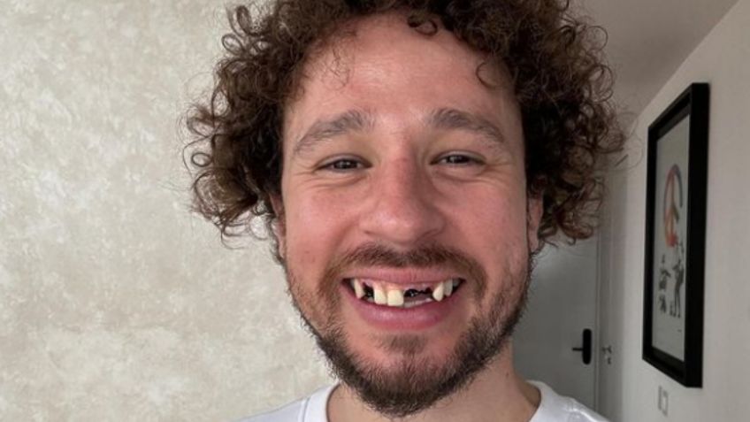 Luisito Comunica: esta es la verdad detrás de la caída de sus dientes, ¿realmente los perdió?