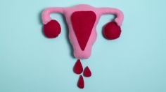 3 enfermedades que puedes tener durante la menstruación y cómo desaparecer los síntomas