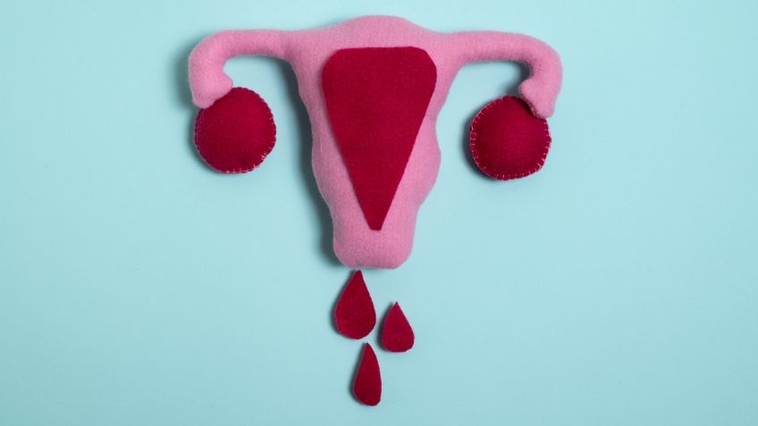 3 enfermedades que puedes tener durante la menstruación y cómo desaparecer los síntomas