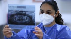 El ISSSTE promueve medidas para prevenir caries, el mayor riesgo de salud bucal