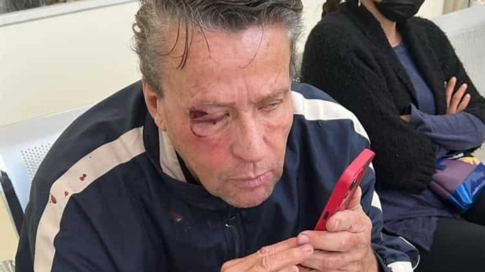 En sus declaraciones, el actor aseguró que él sacó el tubo de su vehículo hasta que vio que su agresor traía un artefacto similar