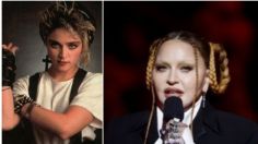 ¿Qué se hizo Madonna en el rostro? La verdad de su impactante antes y después