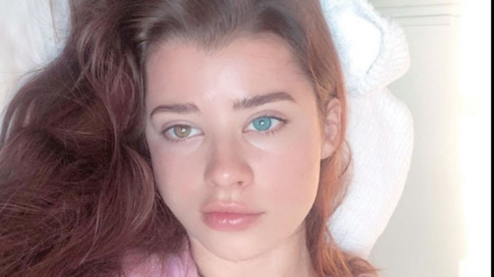 La modelo Sarah Rose Mcdaniel padece heterocromía completa