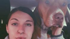 Un perro pitbull muerde a una mujer y le destroza la nariz: ahora le crece pelo en la cara