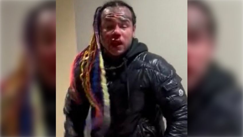 IMÁGENES FUERTES | Tekashi 6ix9ine hospitalizado: fue brutalmente golpeado en un gimnasio