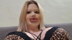 Esta influencer tiene los labios más grandes del mundo, esta es la fortuna que ha gastado en cirugías