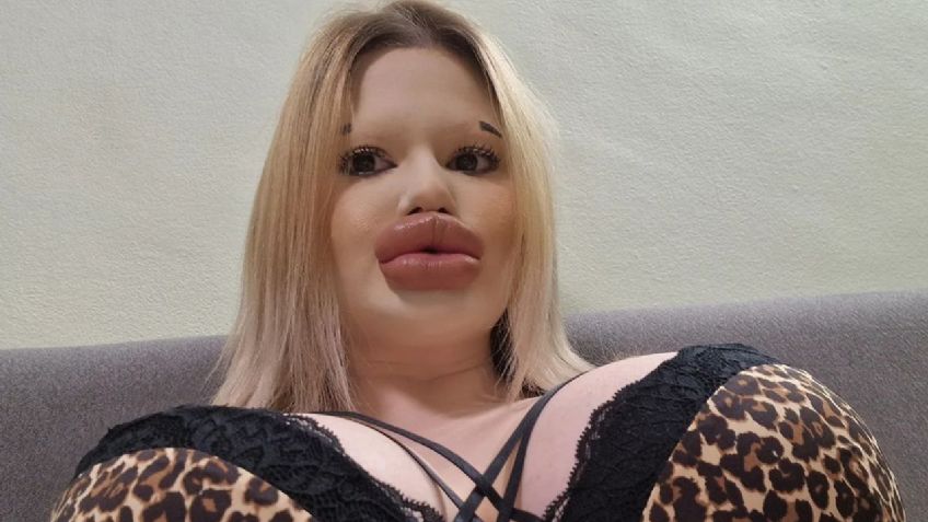 Esta influencer tiene los labios más grandes del mundo, esta es la fortuna que ha gastado en cirugías