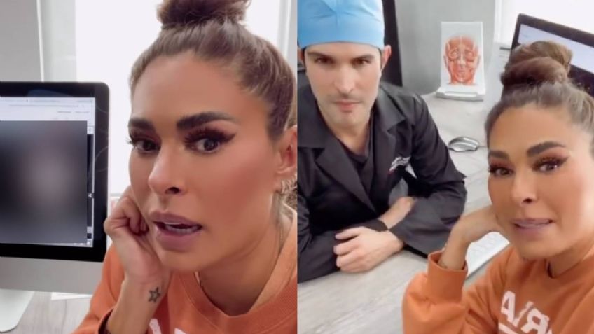 ¿Galilea Montijo se somete a cirugía estética? Esto reveló la querida conductora de "Hoy"