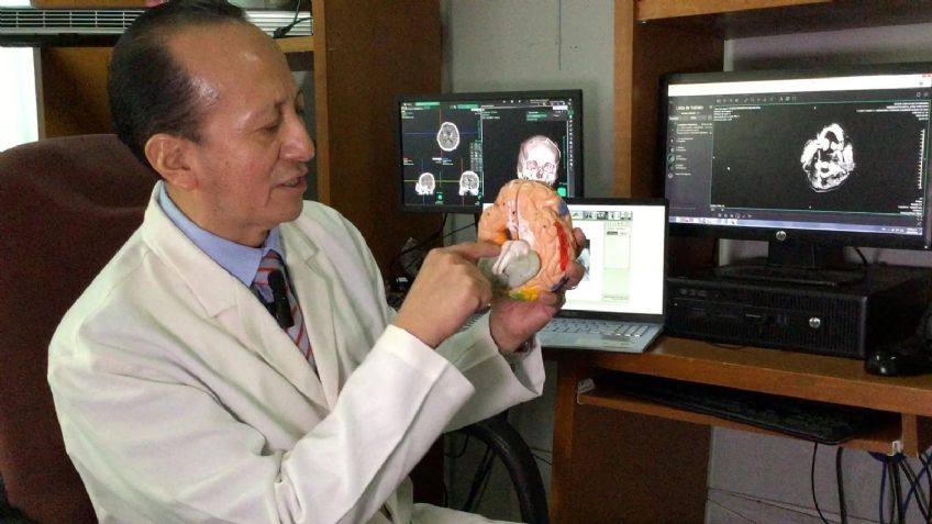 ISSSTE implanta chip cerebral a pacientes con Parkinson