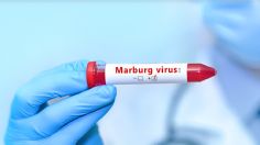 ¿Otra pandemia?: Aumentan los casos de virus de Marburg similar al ébola