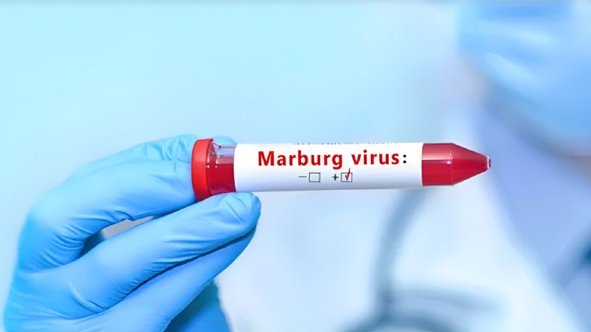 ¿Otra pandemia?: Aumentan los casos de virus de Marburg similar al ébola