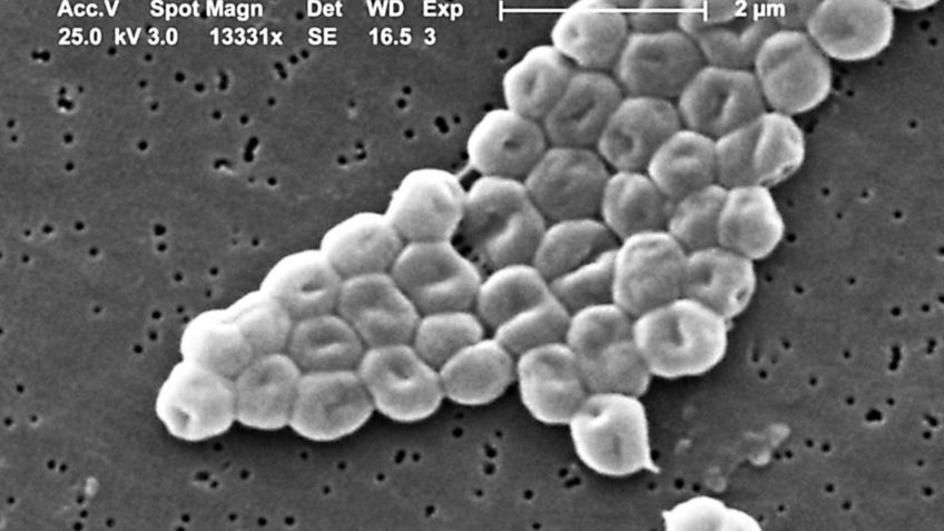 Alerta epidemiológica: brote de una bacteria súper resistente a los antibióticos pone en jaque a los científicos