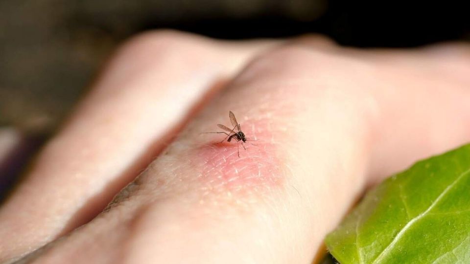 Las picaduras de mosquito no solo causan bultos rojos y picazón, sino que también pueden transmitir parásitos y virus, convirtiéndose en enfermedades graves.