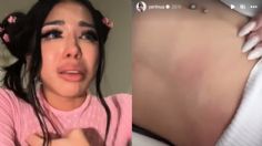 Yerimua aparece con golpes en la cara y alerta a sus fans