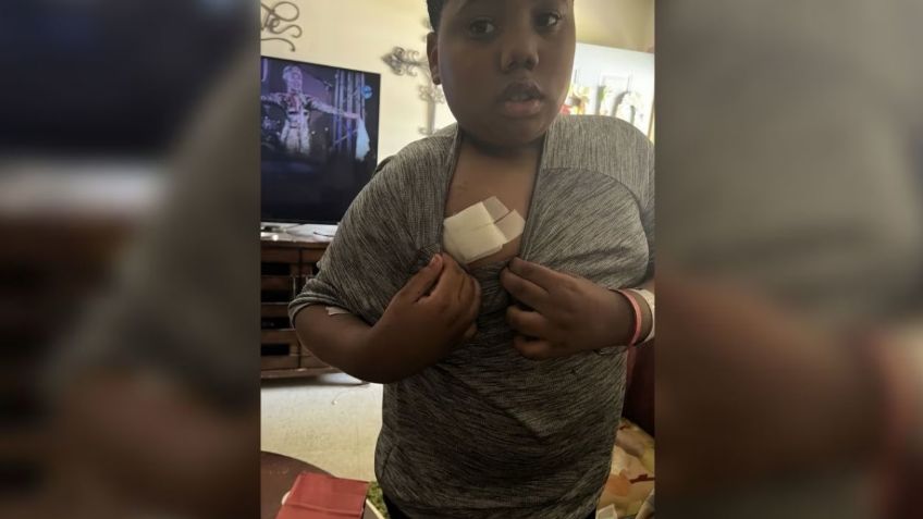 ¡Increíble! Policía de Mississippi balea a niño de 11 años