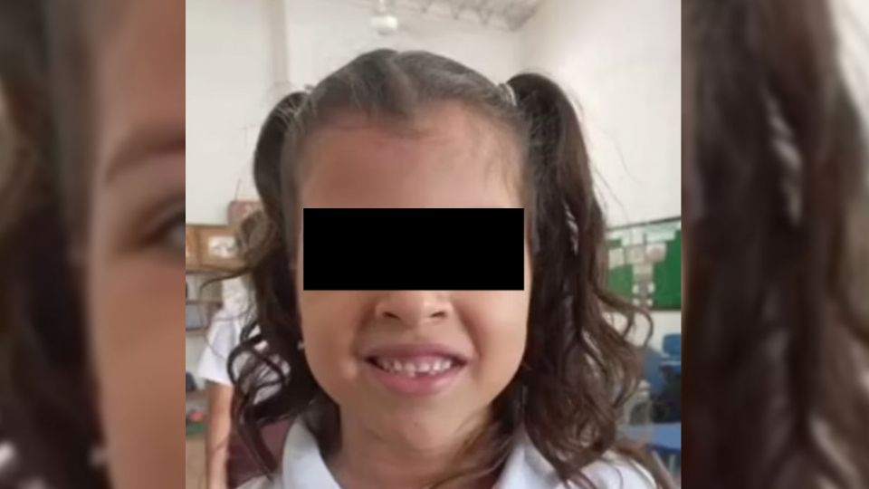 La pequeña colombiana falleció luego de una visita al dentista.