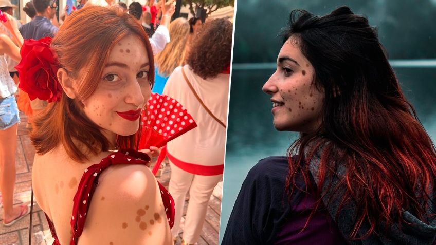 La increíble historia de Alba Parejo: la mujer viral que marca tendencia en TikTok por sus lunares