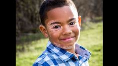 Niño con vitiligo se curó de profunda depresión al conocer a un perro con su misma enfermedad