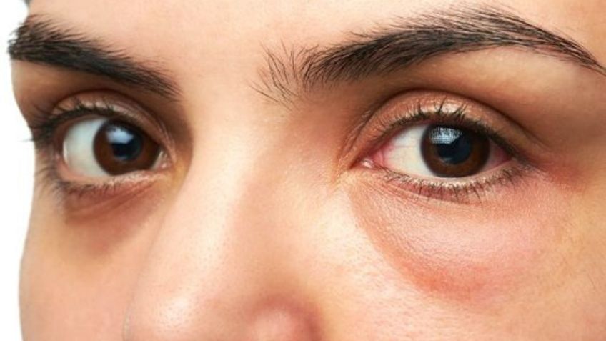 Adiós a las bolsas de los ojos: conoce la vitamina infalible para eliminarlas